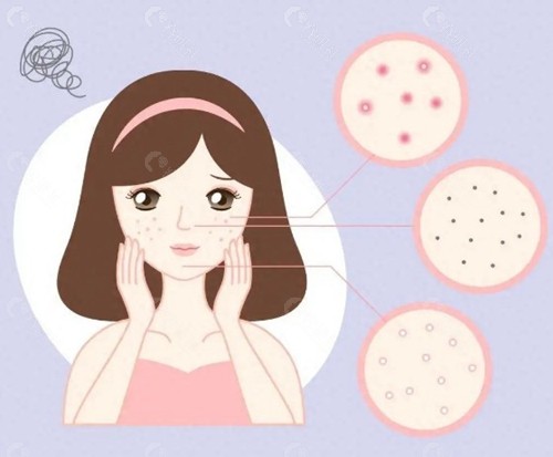 避坑指南：在日本做皮肤管理要注意什么？