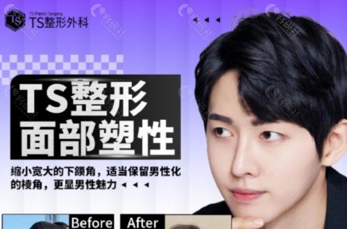 韓國TS整形外科怎么样？