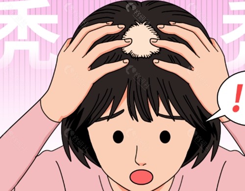 汉中卓美医疗美容治疗脱发怎么样