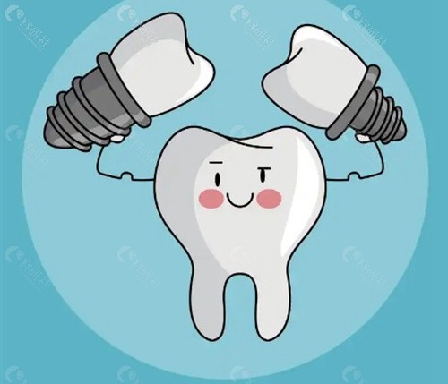 為什麼業內医师更推薦「埋入式」？