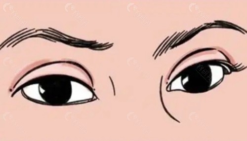 陈贵宗：技术派，擅长“微创”与“精细”操作