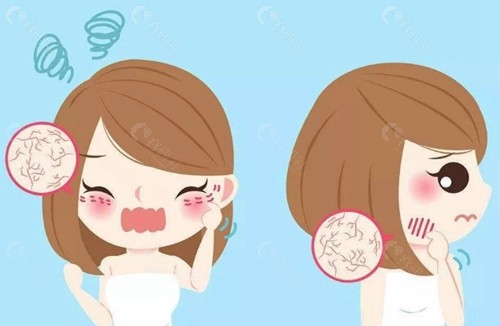 Q3：敏感肌应该用什么洗脸？