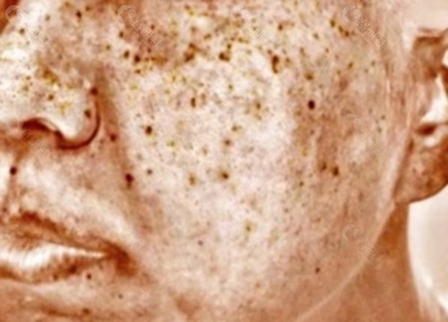 韶关华美祛斑怎么样