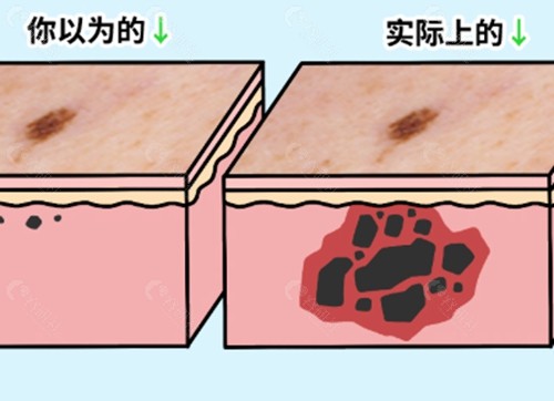 韶关时光整形祛斑怎么样