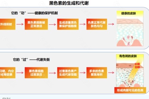 韶关丽港妇科病院（医美中心）祛斑好吗