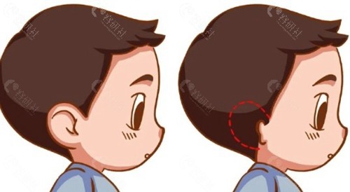  恢复时间线：从出院到回归正常生活