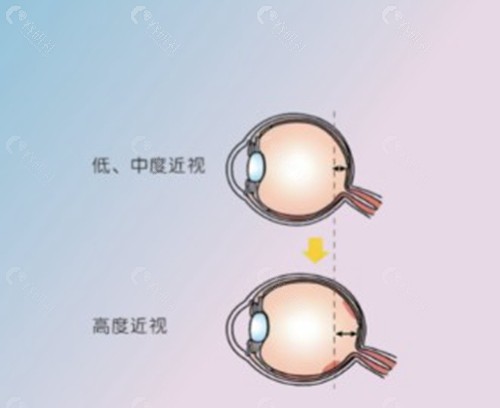 核心区别：是“标准化”还是“个性化”？