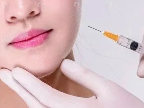 淮南金维整形注射瘦脸怎么样