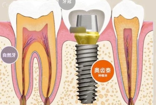 泰安古德口腔怎么样