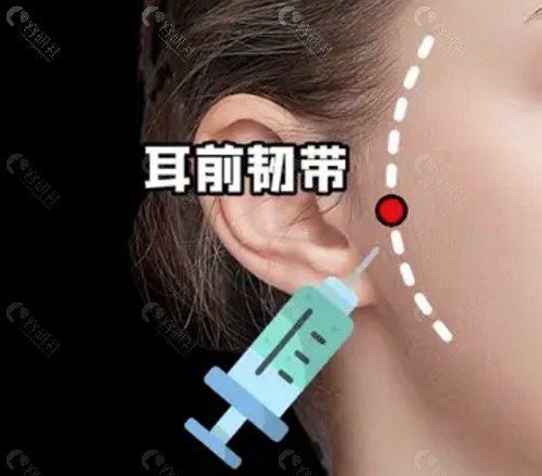 打完脸到底会不会变宽？