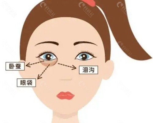 内窥镜取泪沟异物多少钱？