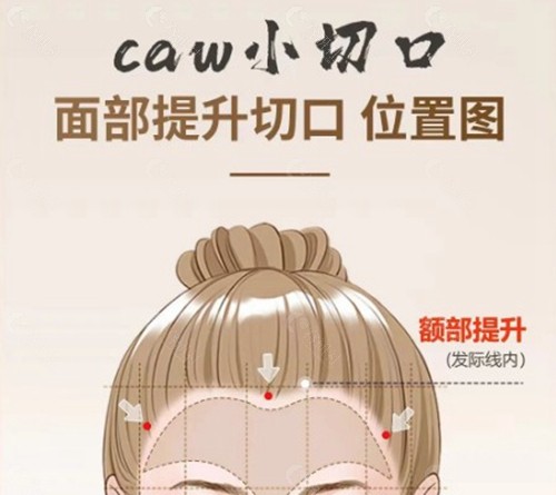 价格体系：分层定价