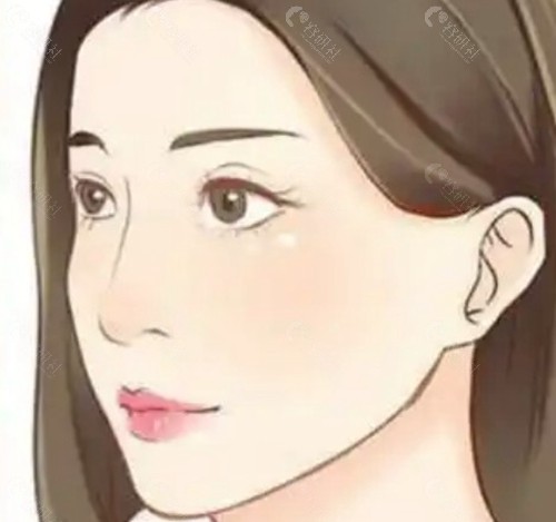 贵在哪里？解析CAW技术的“溢价”逻辑