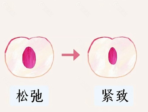 南昌仁爱华美做私密手术好吗
