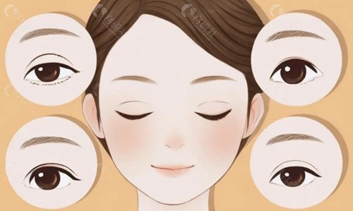 “抽线”不是简单的物理抽离