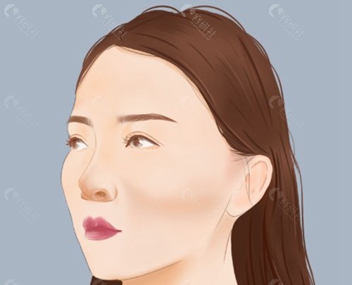 1. 手术原理：移动 vs. 重塑
