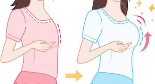 1. 魔滴Motiva的Qid®芯片会触发金属探测器吗？