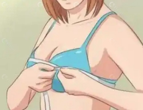 2. 全身扫描仪（Body Scanner）会看到假体吗？