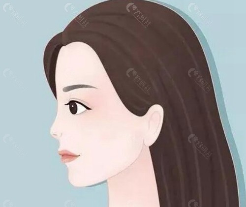 隆鼻手術：結構重建的长久方案