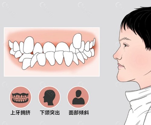 上下颚骨咬合错位挂什么科？