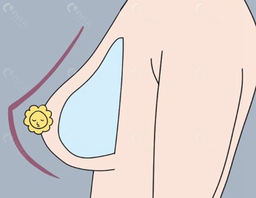 拆线缝合：传统技术的“稳扎稳打”