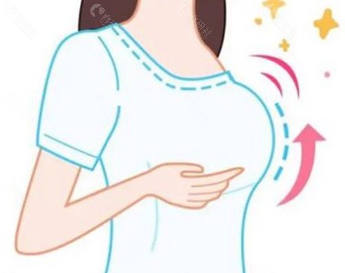 假体隆胸两个月外面软里面硬正常吗？