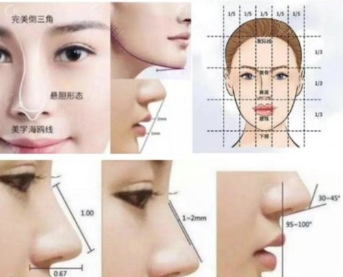 长治铭医悦美隆鼻好吗