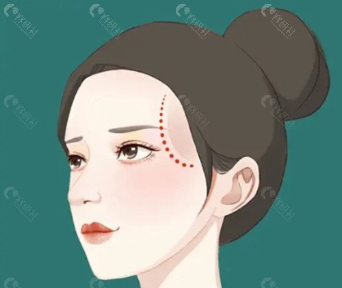 判断你属于哪种“填充过量”