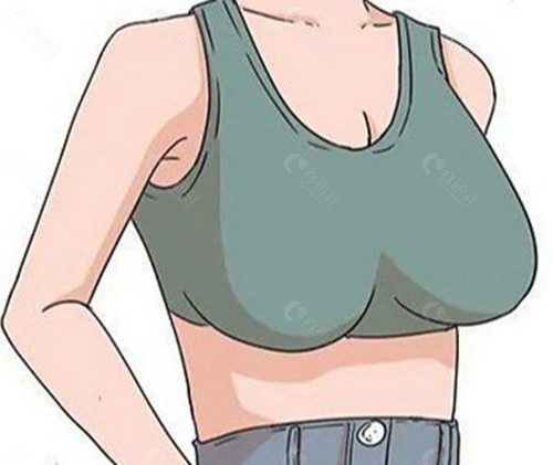 栗勇巨乳缩小手术好还是李高峰好？