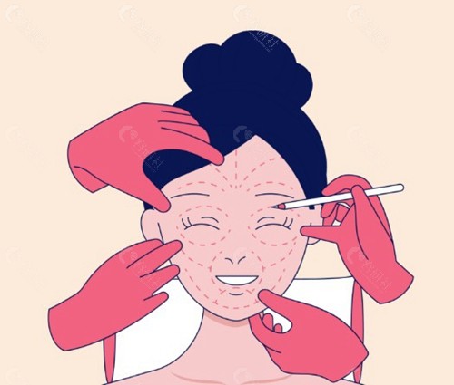 林靖双眼皮修复什么价位？
