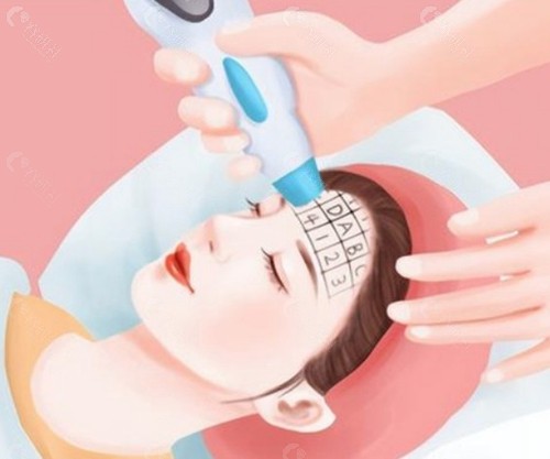  光電提升類：緊致輪廓的「黑科技」