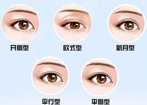 盘锦摩登美学医疗美容割双眼皮怎么样