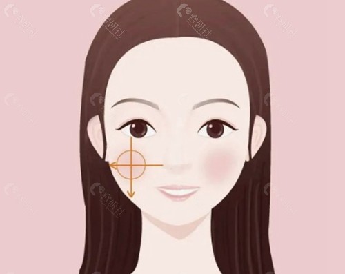 夏志冉五维筋膜提升：专注“力学重建”