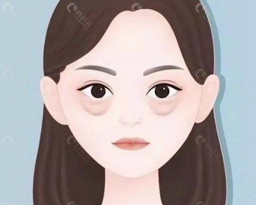 真相揭秘：所谓的“不开刀”分两种
