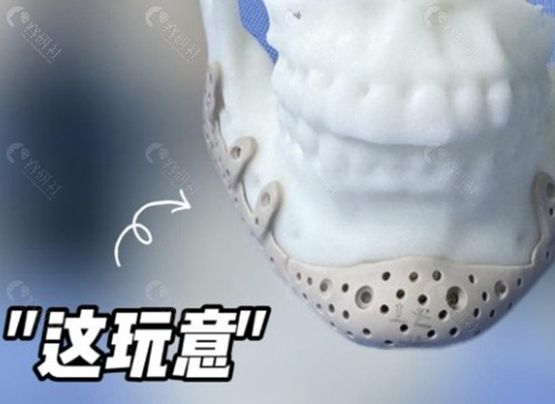 17万预算够不够？费用大起底