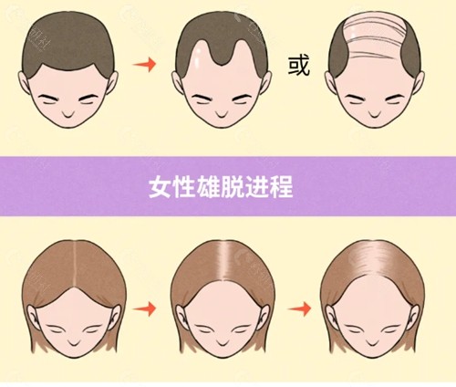 济宁格莱美整形治疗脱发好吗