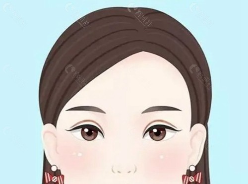 广州阮庆玲医生：眼修复的技术流分析