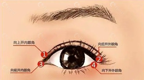 开内眼角还是外眼角显眼大
