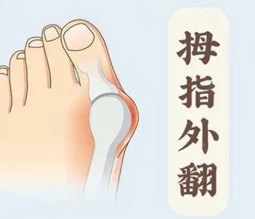 侯明：强调“超微创”与生物力学还原