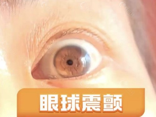 门槛一：有没有“中间带”？这是手术的关键