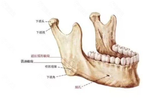 黄大勇和何照华下颌角手术哪个做的好？