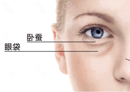 卧蚕用玻尿酸还是胶原蛋白好