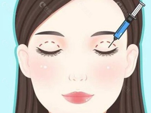 2. 黄军伟：综合眼部整形