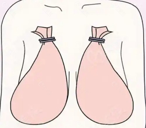 医生实力：深耕乳房整形，专注功能与美学并重