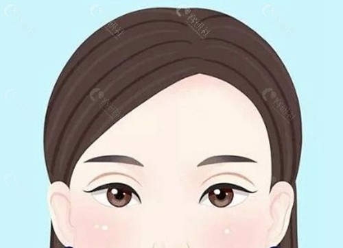 韩国双眼皮修复领域医生大盘点