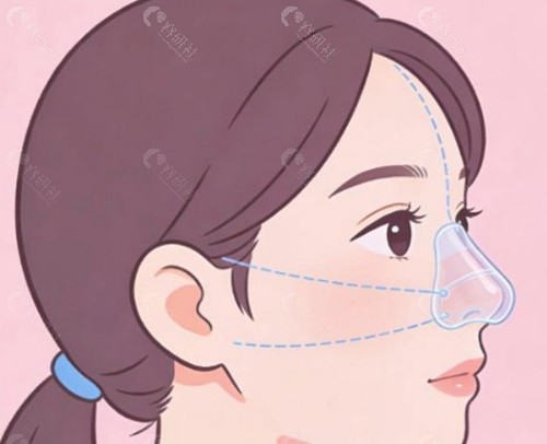 为什么价格会有差异？影响费用的三大核心因素