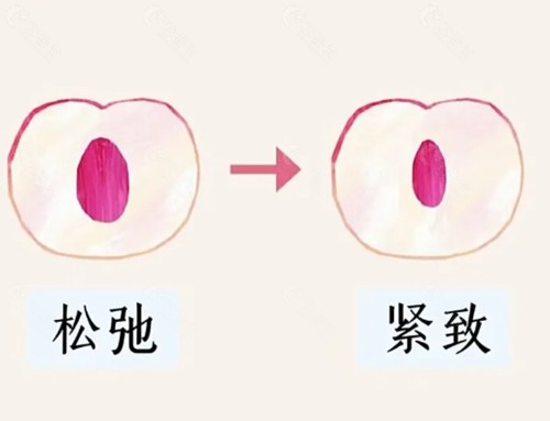 无锡施尔美美容医院做私密手术好吗