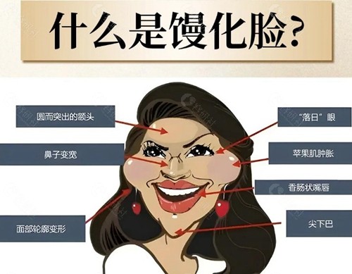 吴贞跃做馒化修复靠谱吗？技术特色分析