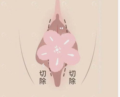 菏泽禾丽医疗美容做私密手术好吗
