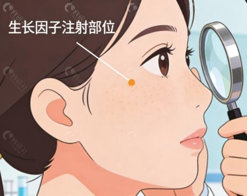 王绍国取生长因子2026年价格参考